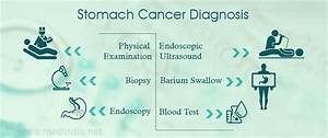 Stomach Cancer Gastric Cancer