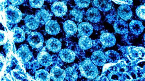 Coronavirus: 7 types of human coronavirus - AS.com