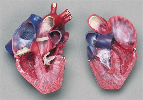 Life Size Diseased Heart Model Scientific Publishing