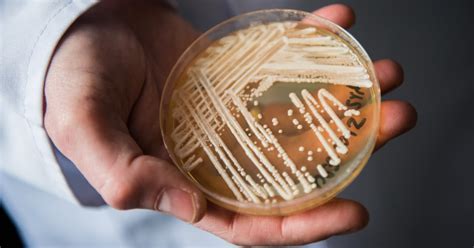 Deadly Fungal Infection Spreading At An Alarming Rate Cdc Says