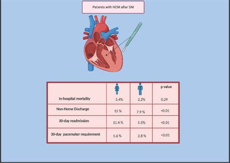 Sex Based Outcomes Of Surgical Myectomy For Hypertrophic Cardiomyopathy Journal Of The