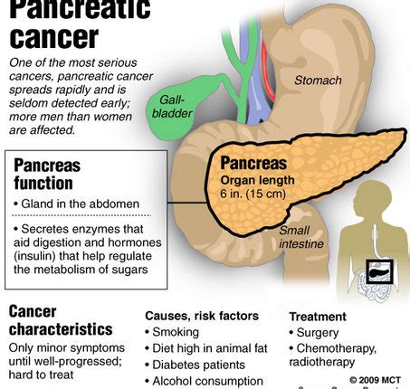 Pancreatic cancer occurs within the tissues of the pancreas, which is a vital endocrine organ located behind the stomach. Pancreatic Cancer Causes, Prognosis and Treatment —Health ...