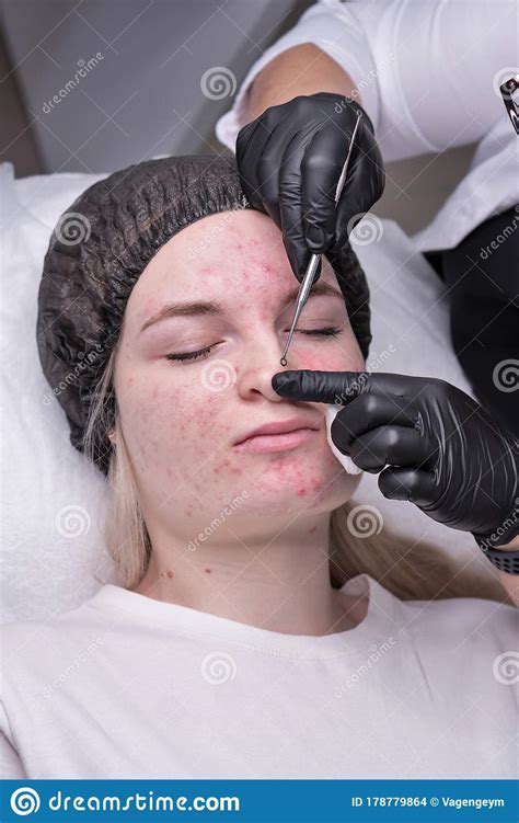 Mechanical Facial Cleansing Stock Photo Image Of Care Mechanical