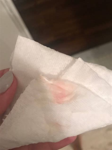 very light pink discharge when i wipe pregnant