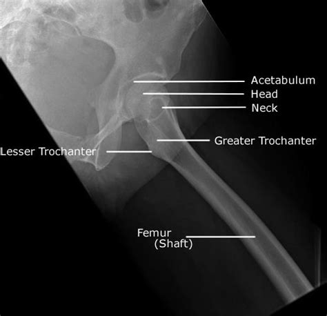 Radiographic Positioning Lower Limb