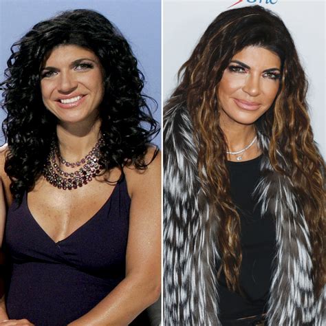 Real Housewives Plastic Surgery Before And After Photos