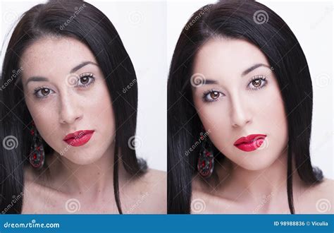 Young Woman Before And After Retouch Beauty Treatment Before And
