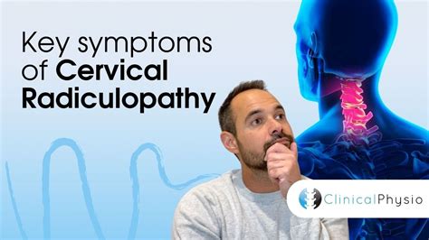 Key Symptoms Of Cervical Radiculopathy Expert Physio Guide Youtube