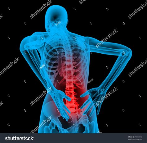 As a nurse, you will need to know the basic about the human skeleton. Human Backbone Xray View Back Pain Stock Illustration 73006915 - Shutterstock