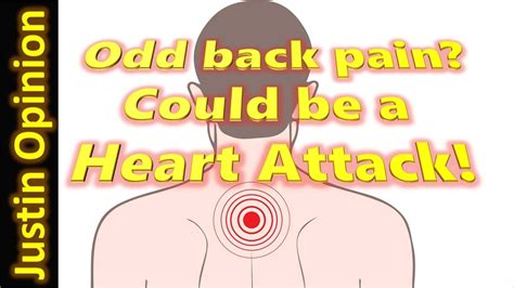 Back Pain Could Be A Heart Attack Youtube