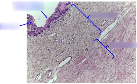 Vagina Layer Histo Diagram Quizlet