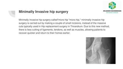 Ppt Hip Replacement Surgery Surgical Procedures Powerpoint
