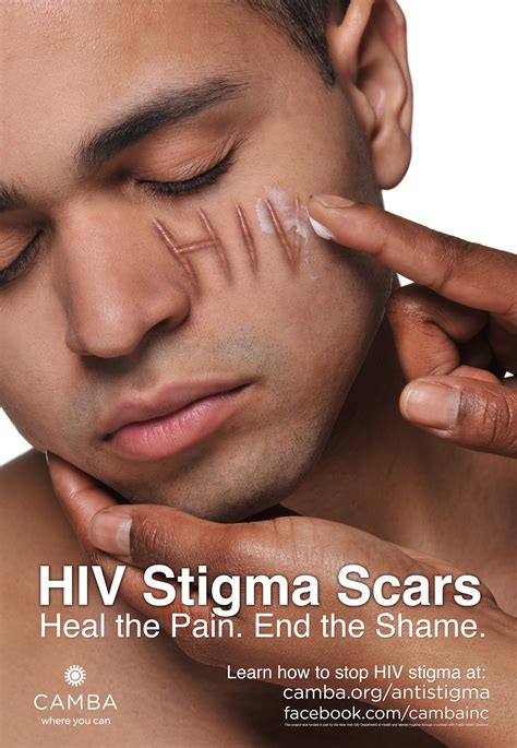Hiv Anti Stigma Advocacy Getting Out Of Hand Now
