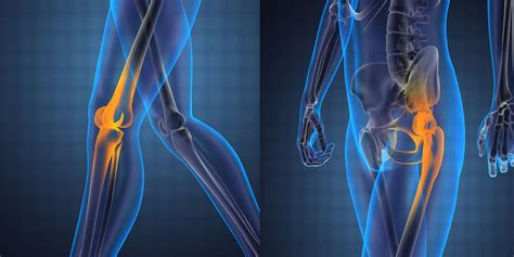 Knee And Hip Replacement - Orthopedic Surgeon Monmouth County NJ