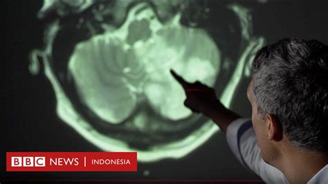 Virus Corona Apa Dampak Covid 19 Bagi Otak Manusia Bbc News Indonesia