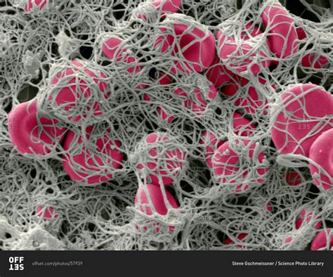 Color Scanning Electron Micrograph Of Red Blood Cells Erythrocytes