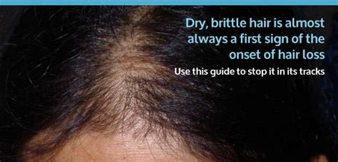 Is Your Hair Dry And Brittle You Might Be Experiencing The Early