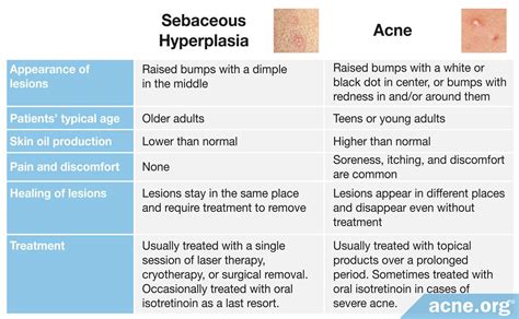 What Is Sebaceous Hyperplasia And Is It The Same As Acne