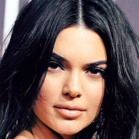 Kendall Jenner Responds To People Criticizing Her Acne