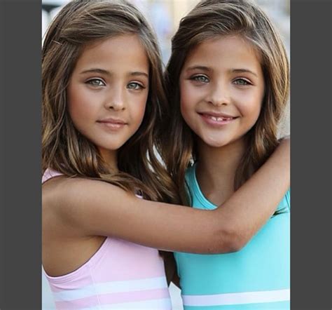 Il y ans nous avons connu les plus belles jumelles du monde à quoi ressemblent elles