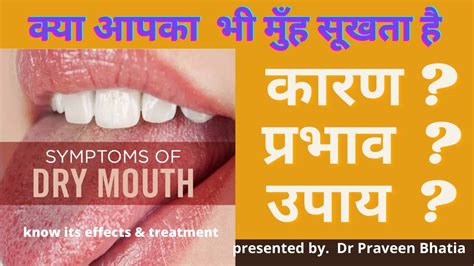 मुंह सूखनाdry Mouth कारण प्रभाव उपाय Reasons Effects Treatment