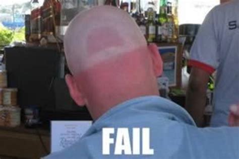 15 Epic Tanning Fails That Prove Some People Should Just Stay Indoors