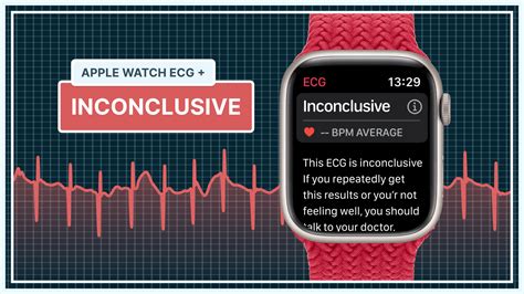 What Inconclusive Ecg Means On Your Apple Watch Qaly