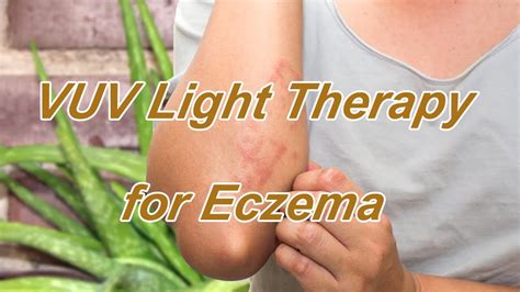 Vuv Light Therapy For Eczema Youtube