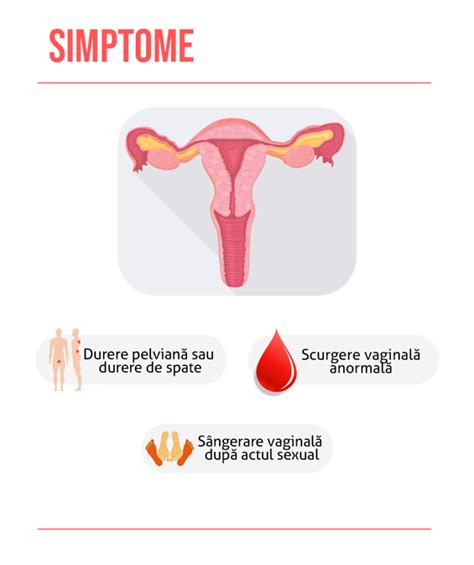 Cancer de col uterin cauze simptome și tratament Medic Chat