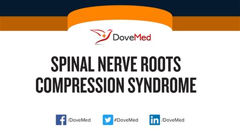 Spinal Nerve Roots Compression Syndrome