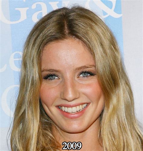 Annabelle Wallis Nose Job Plastic Surgery Before And After Photos
