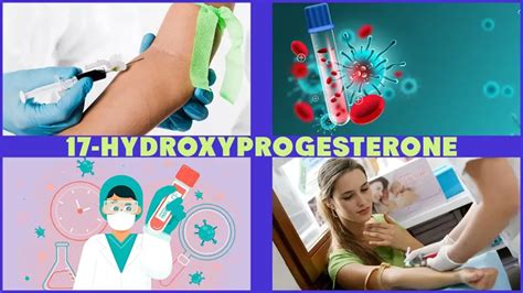 17 हाइड्रोक्सी प्रोजेस्टेरोन टेस्ट 17 ohp test in hindi homeopathic medicine and treatment