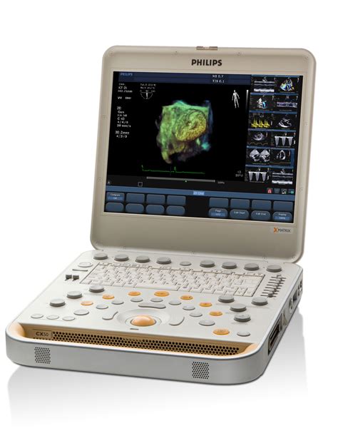 Philips CX50 Ultrasound - Ultra Select Medical