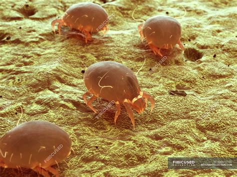 Dust Mite Bites Photos Dust Mite Bites Pictures Symptoms Treatment Prevention