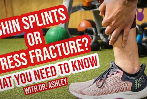 Shin Splints Archives Feldman Physical Therapy And Performance