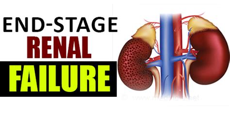It occurs when the glomerular filtration rate drops to 15 or less. What is end-stage renal failure?