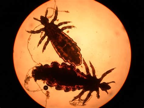 Lice Under Microscope