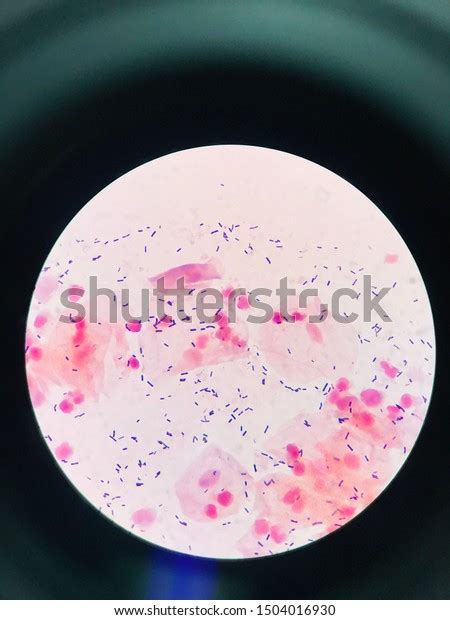 Bacteria Bloodgram Positive Bacilli Microscope Stock Photo 1504016930