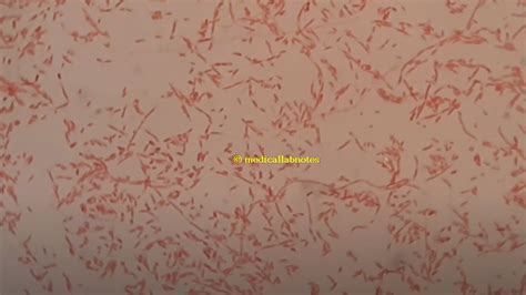 Morphology Of Bacteria Docx Proteus Mirabilis Gram Stain Morphology Sexiz Pix