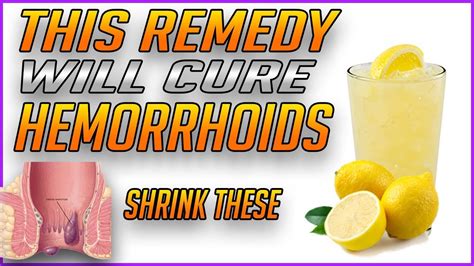 How To Get Rid Of Hemorrhoids Fast And Naturally Best Remedy How To