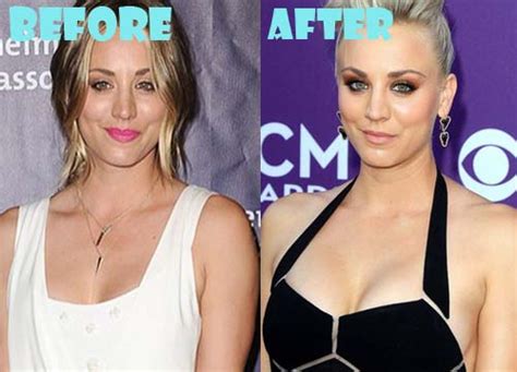 Kaley Cuoco Plastic Surgery Before And After Boob Job Lovely Surgery