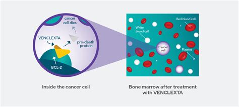 What Is Venclexta® Venetoclax Tablets Aml Treatment