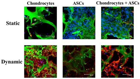 ijms free fulltext cell death in chondrocytes