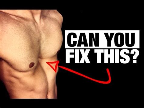 How To Fix Flared Ribs COMPLETE GUIDE