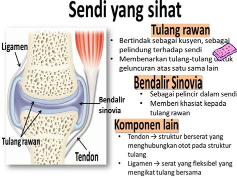 ubat sakit sendi boleh hilang dalam 5 hari kalau.....  Hadiah