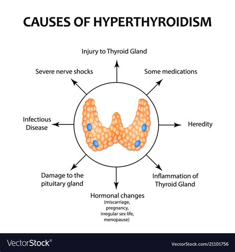 Causes Of Hyperthyroidism Of The Thyroid Gland Vector Image
