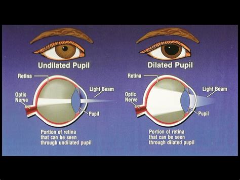 Mydriasis Causes Symptoms And Treatment