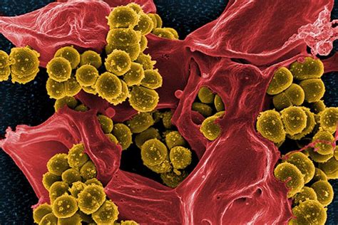 Study Unravels Antibiotic Resistance In Mrsa Superbug Infections