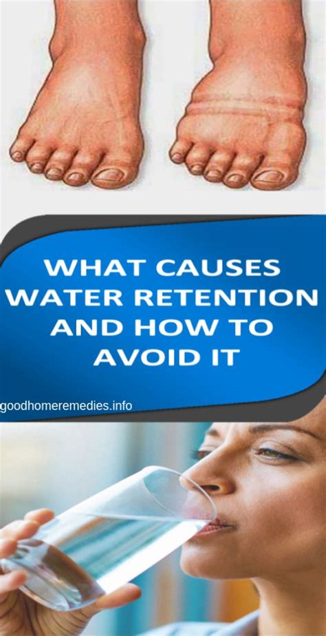 What Causes Water Retention And How To Avoid It Good Home
