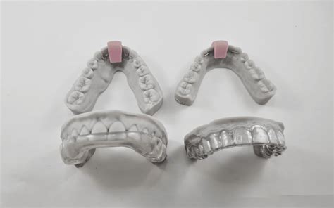 Post Orthodontic Care Avant Dental